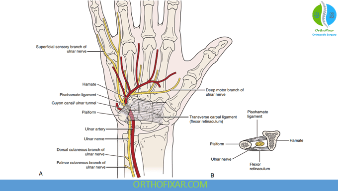 Guyon Canal Syndrome Overview 1 Guyon Canal anatomy