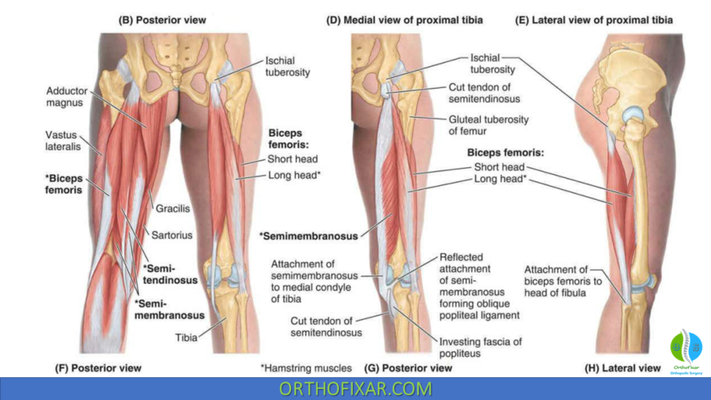 Hamstring Muscles Anatomy Of Biceps Femoris Semitendinosus And 