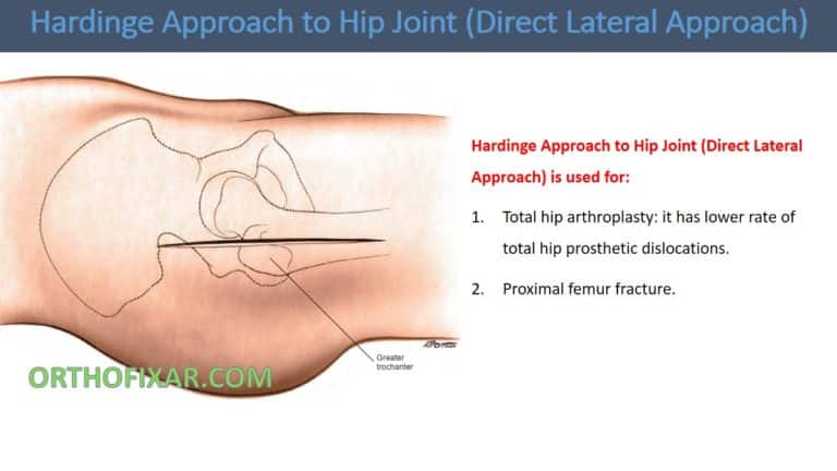 Hardinge Approach to Hip Joint (Direct Lateral Approach)