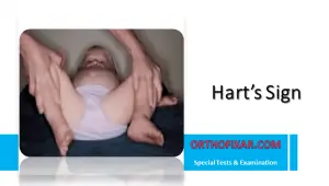 Hart’s Sign