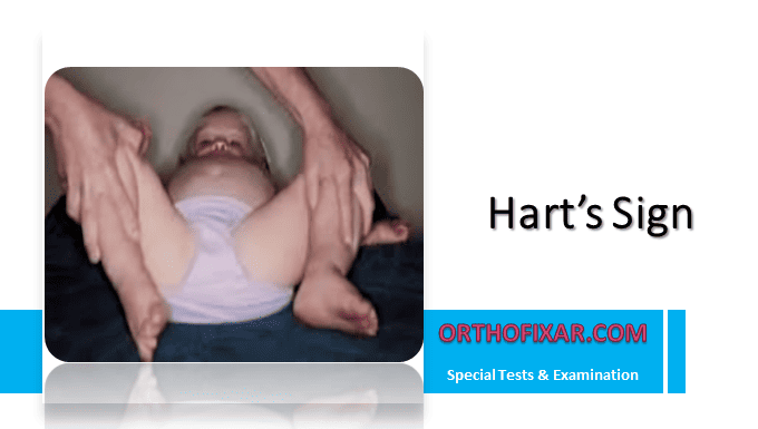 Hart’s Sign