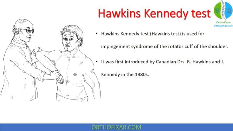 Hawkins Kennedy test