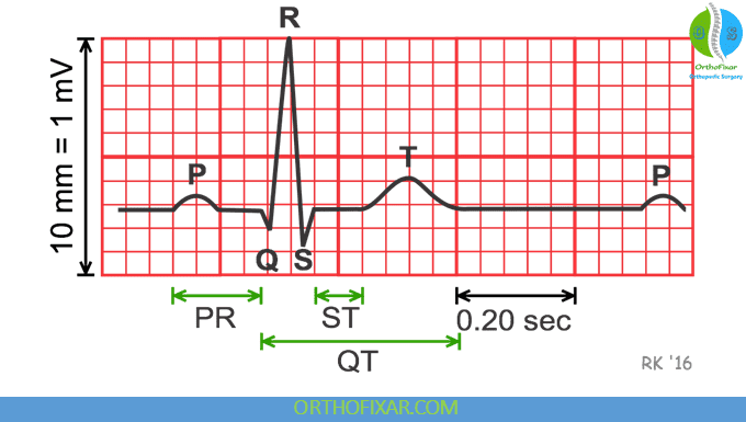 ECG Interpretation for Medical Students: Rate, Rhythm and Axis 8 Heart ECG