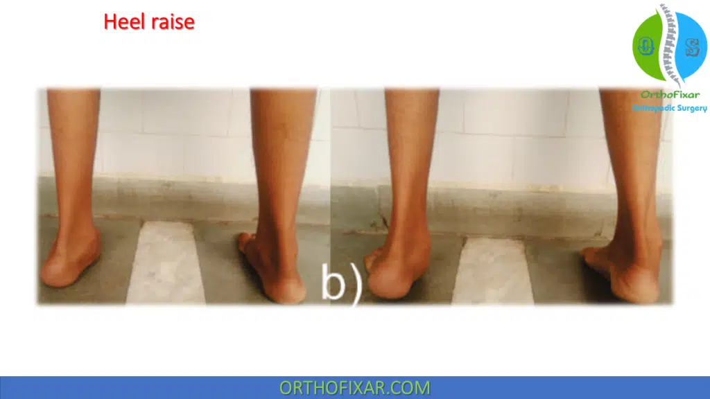 Heel raise