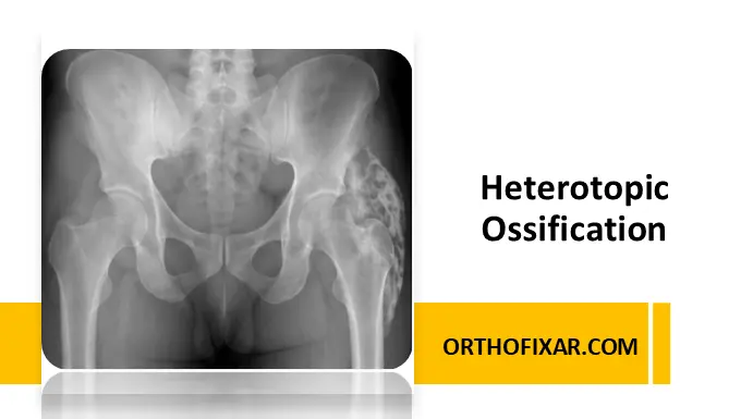 Heterotopic ossification