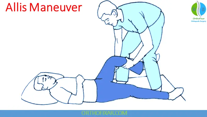 Hip Dislocation reduction - Allis Technique