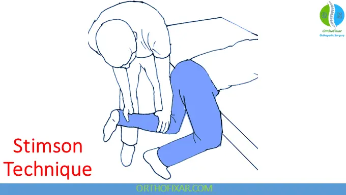 Hip Dislocation reduction - Stimson Technique