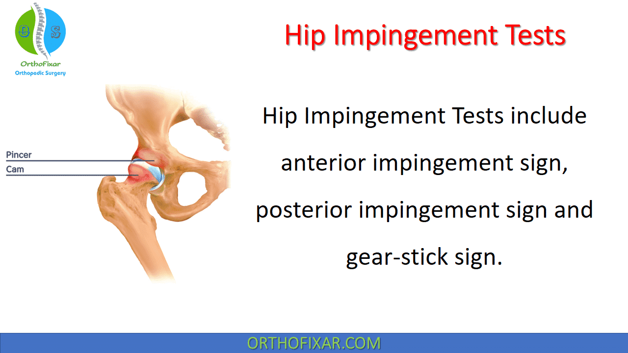Hip Impingement Tests