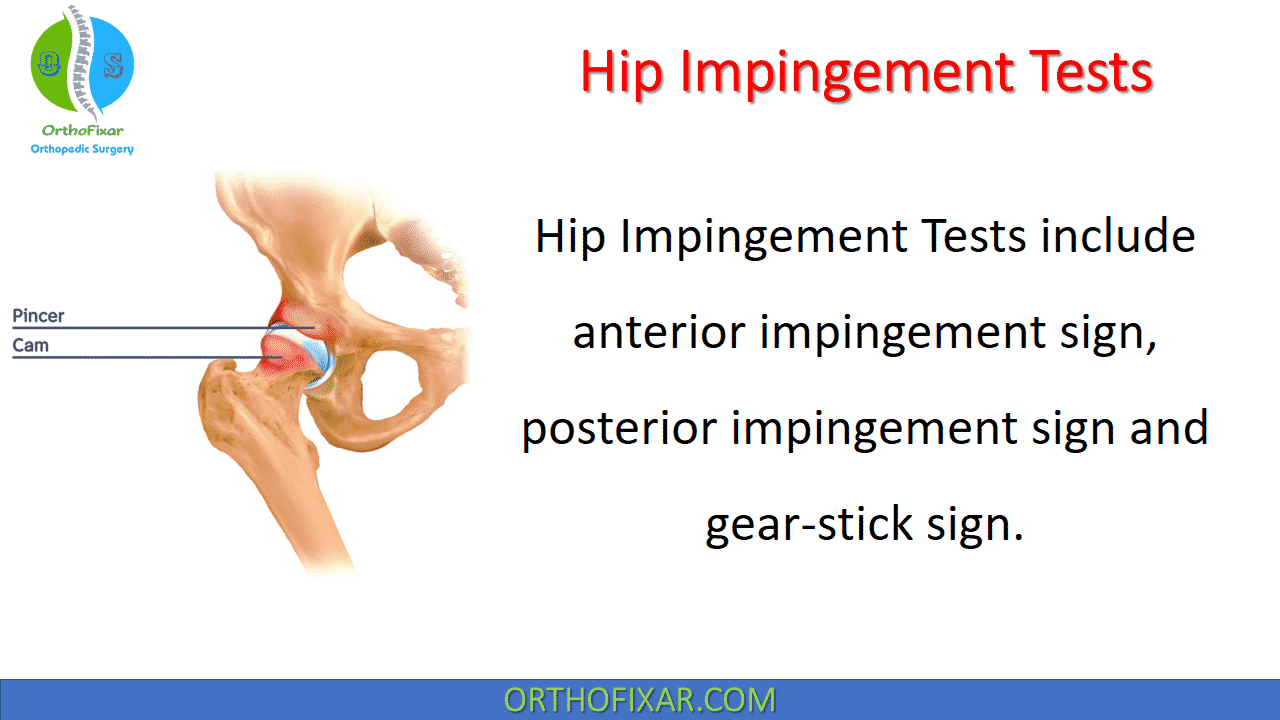 Hip Examination • OrthoFixar 2022