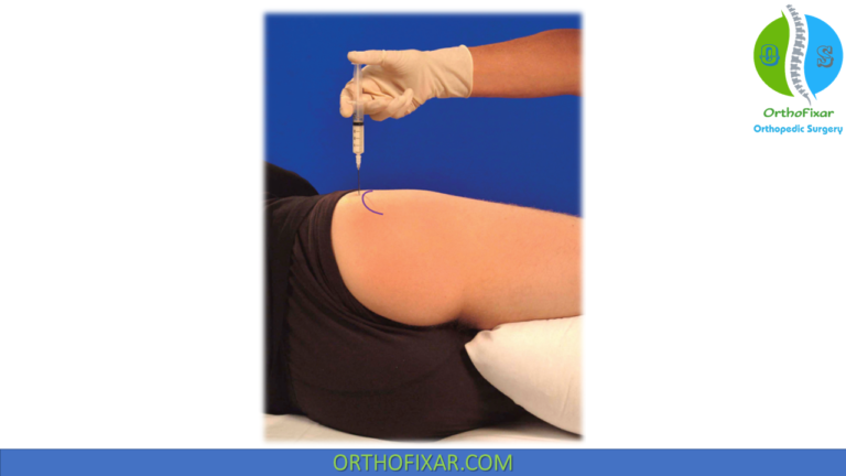 Hip Injection Approach Hip Injection Technique: Lateral Approach Guide With Equipment And Tips