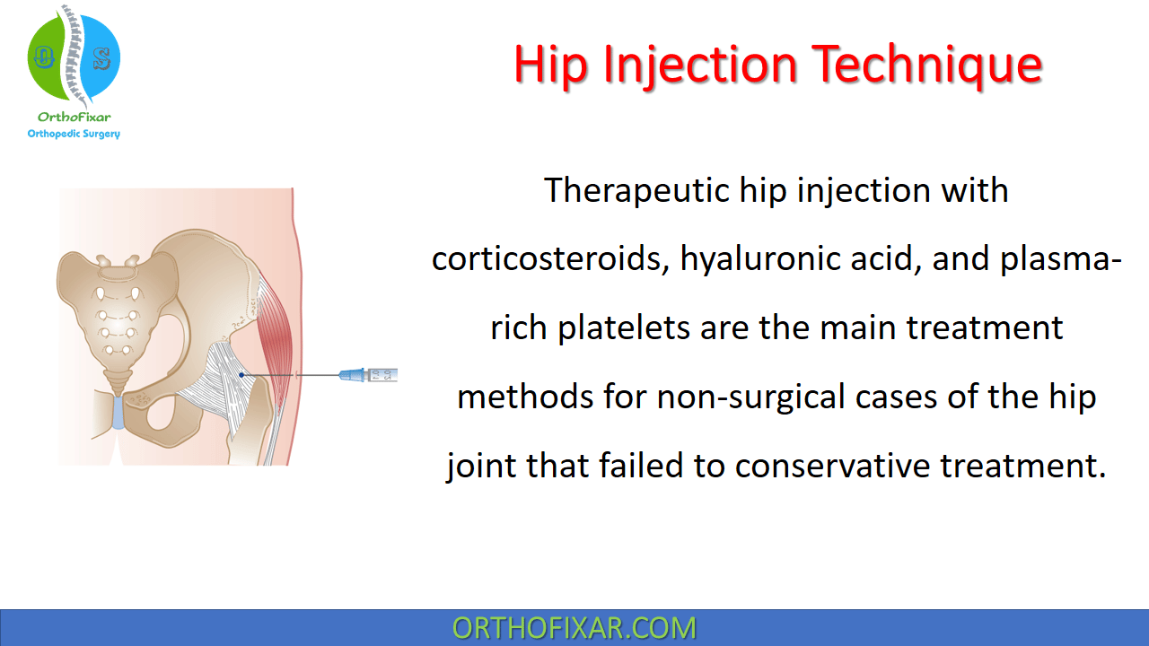 Hip Injection Technique