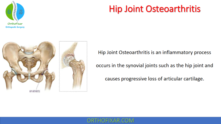 Hip Joint Osteoarthritis