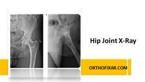 Hip Joint X-Ray Imaging