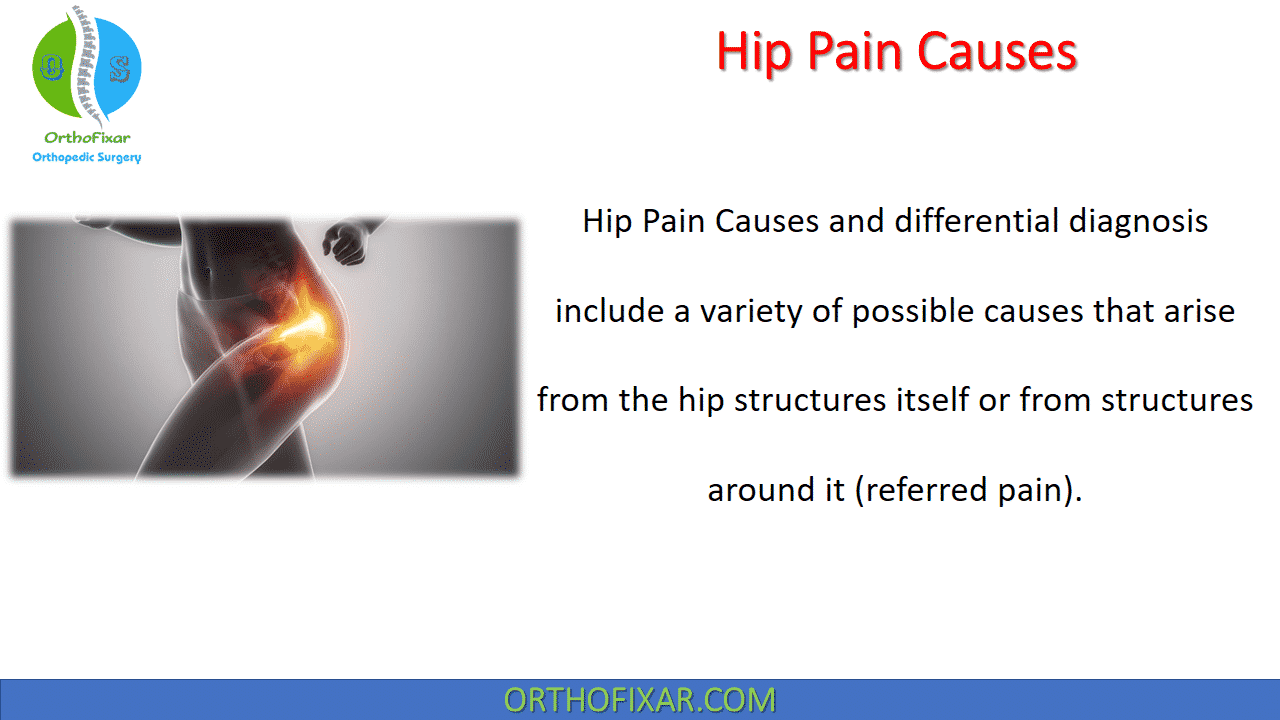  Hip Pain Causes 