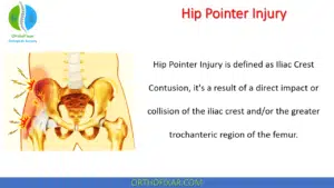 Hip Pointer Injury Causes, Symptoms & Treatment