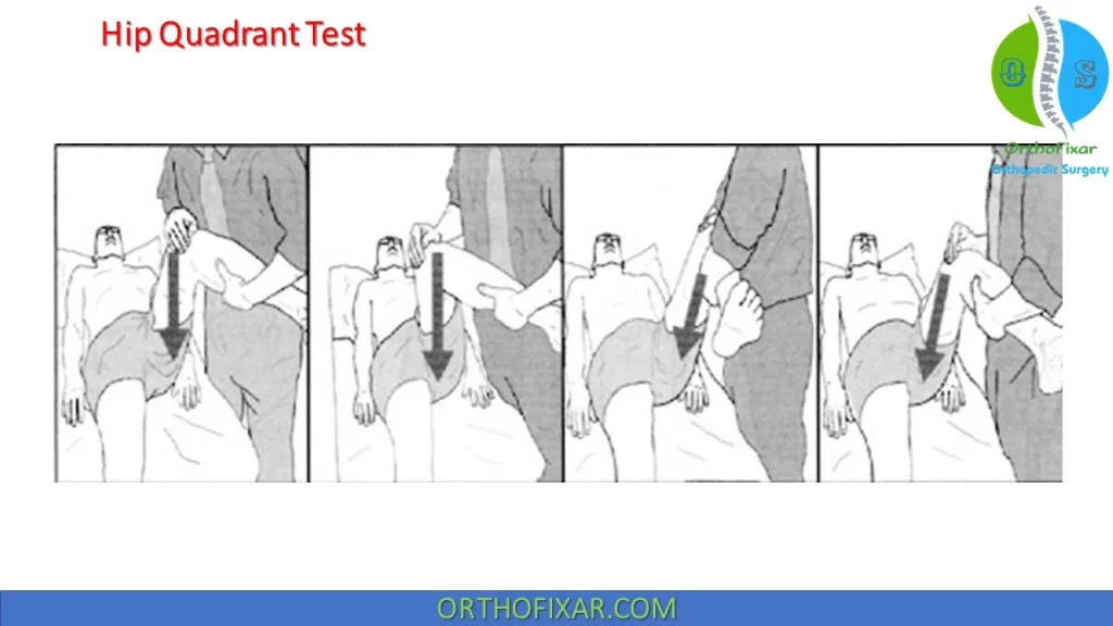 Hip Quadrant Test (scour test)