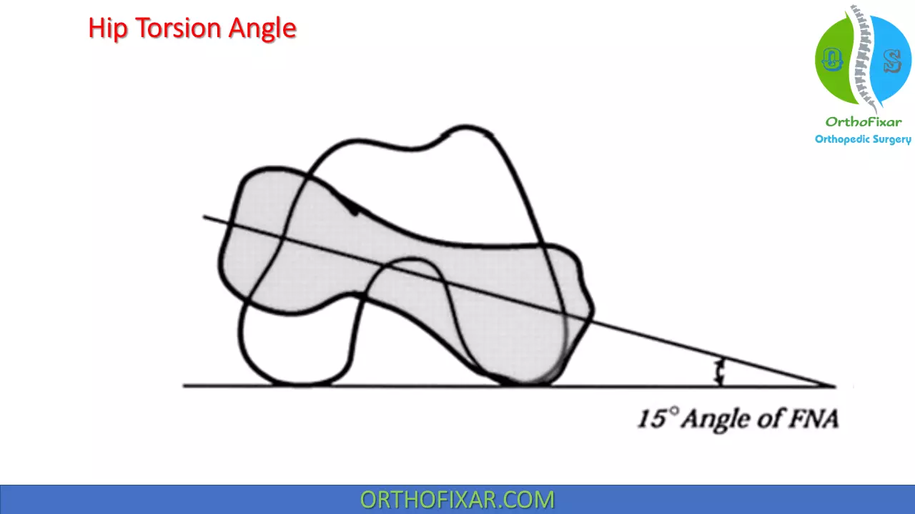 Hip Torsion Angle