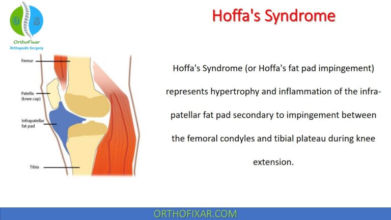 Hoffa's Syndrome