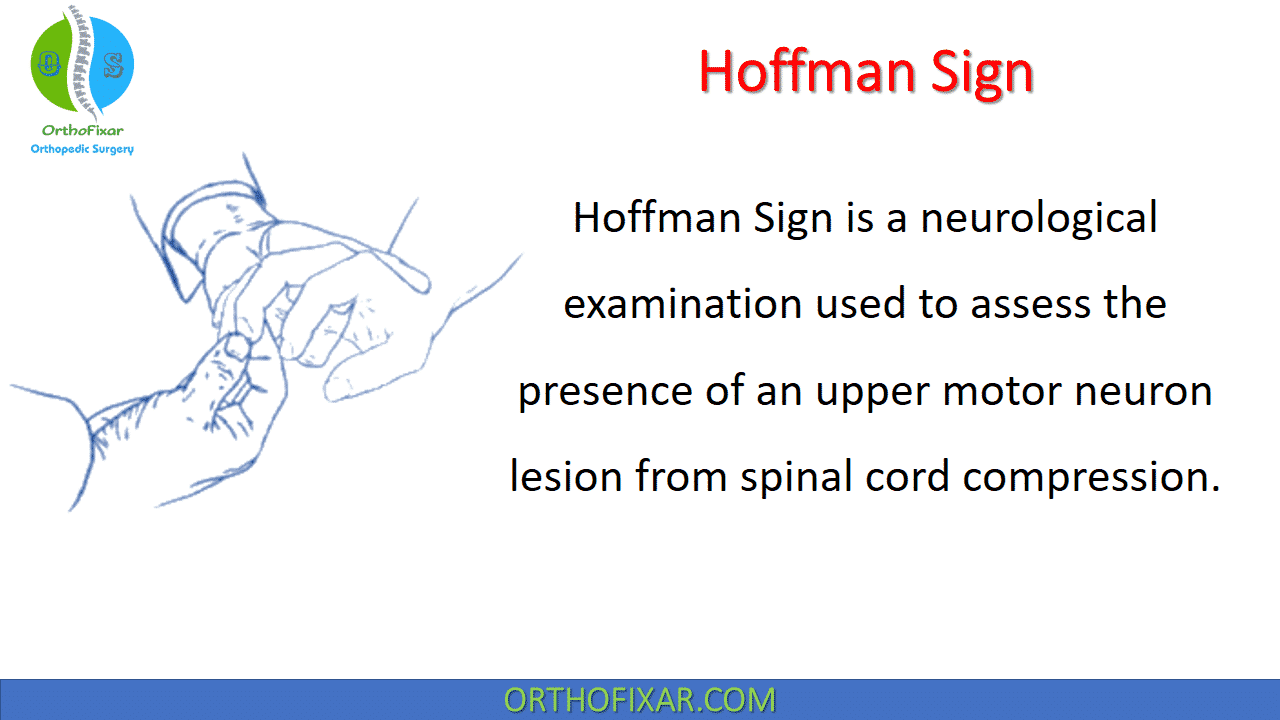  Hoffman Sign for Upper Motor Neuron 