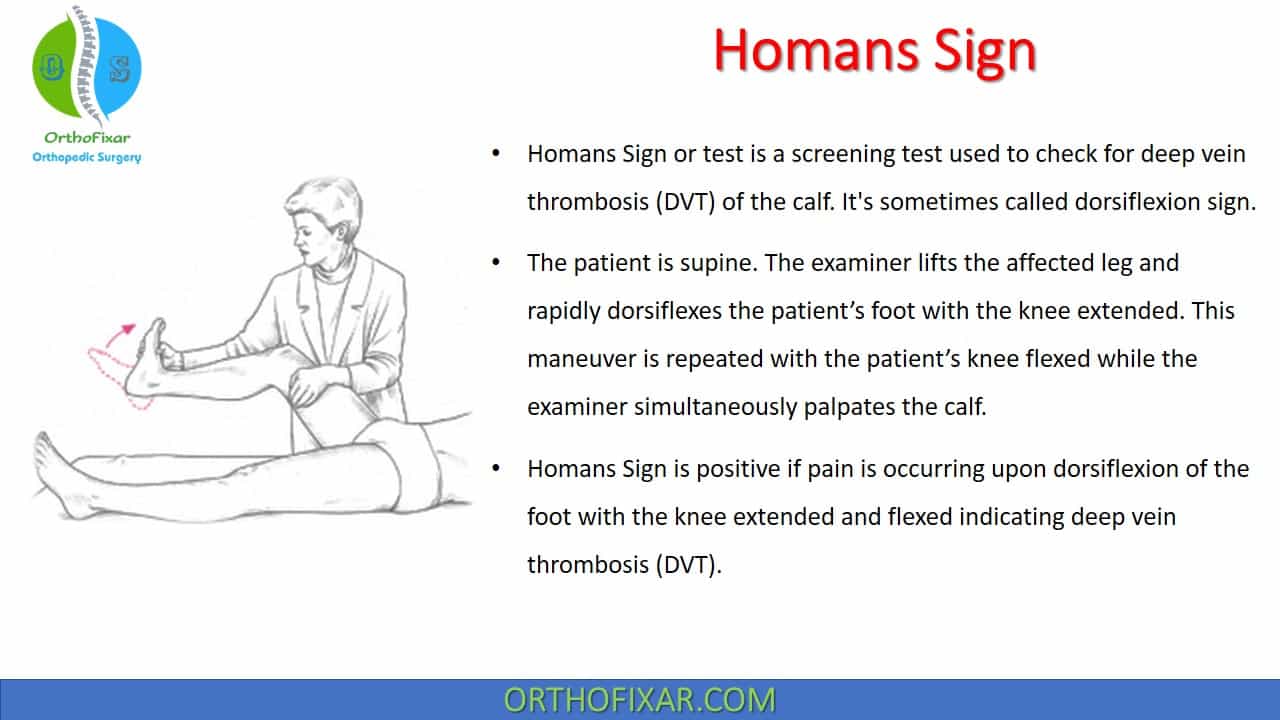  Homans Sign | Absolute Positive Homans Sign Test 