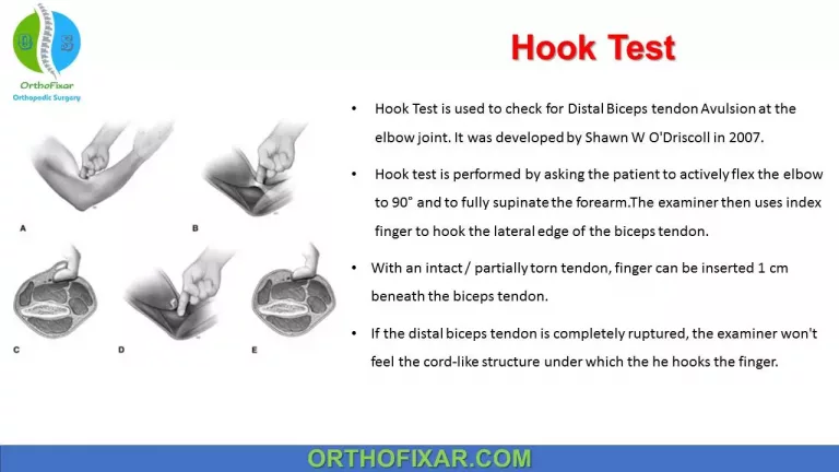 Hook Test