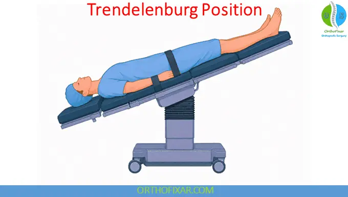 Trendelenburg Position: Uses, Benefits, Indications & Complications 4 How to Place a Patient in the Trendelenburg Position
