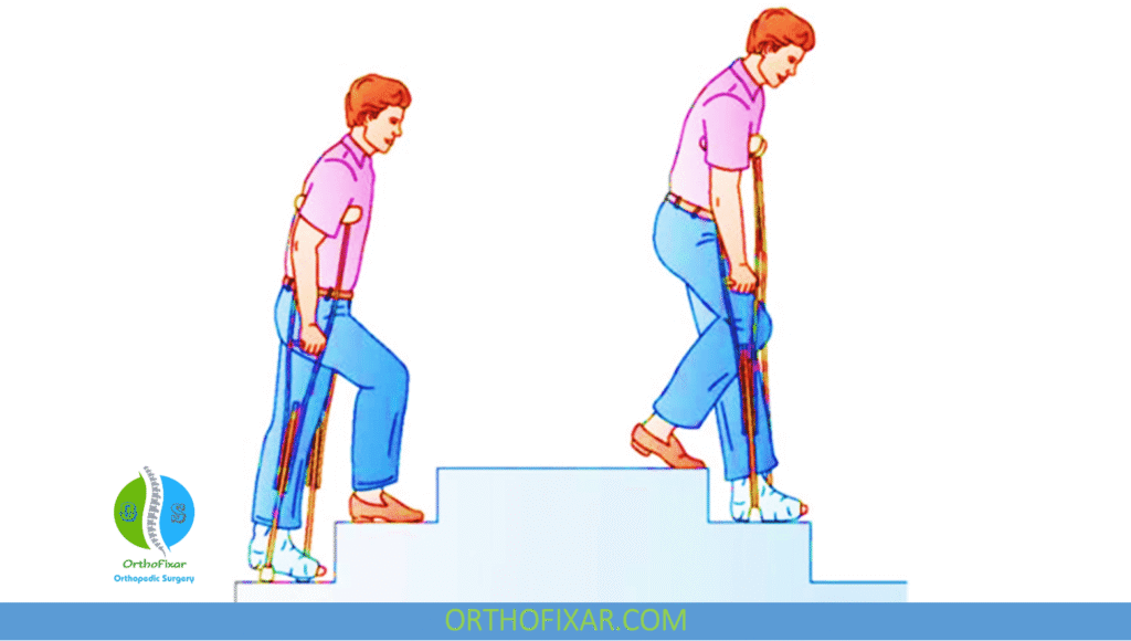 How to Use Crutches Safely on Stairs