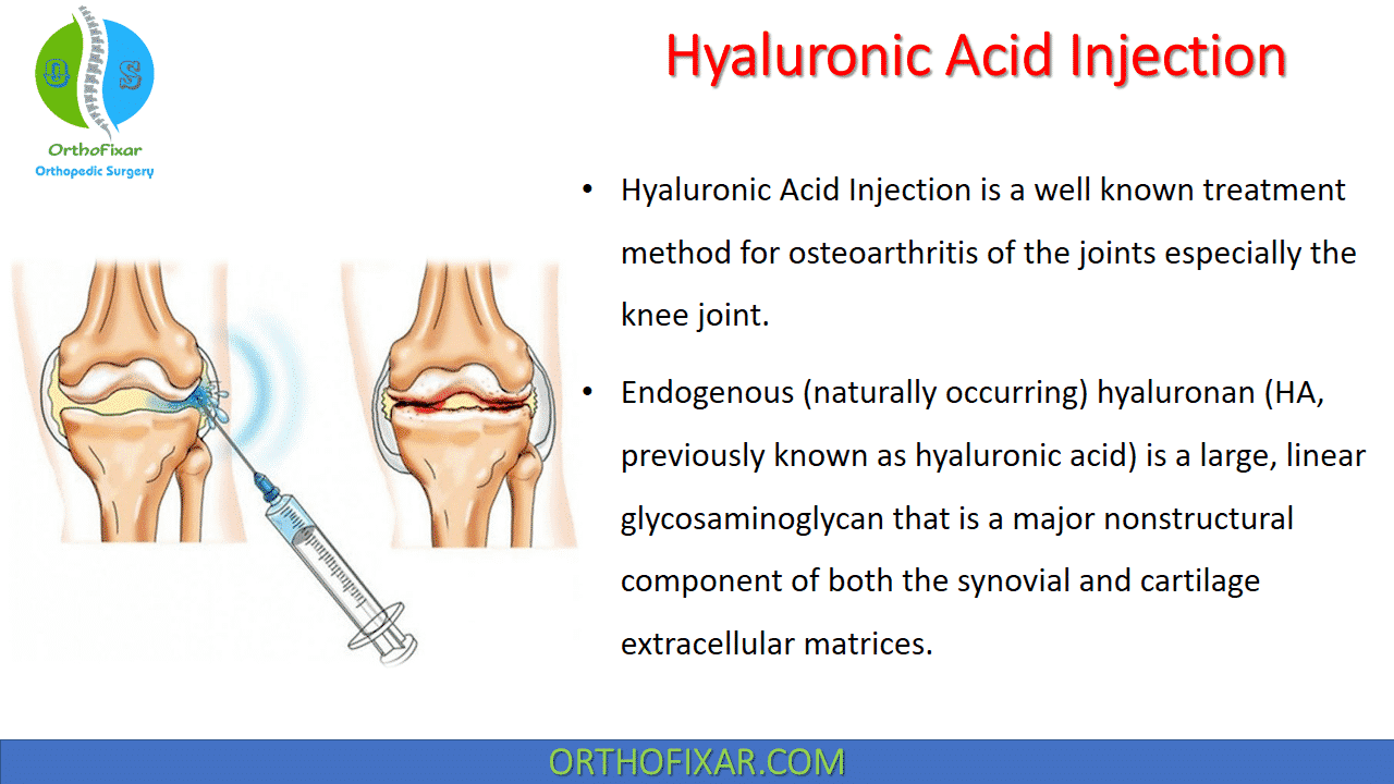  Hyaluronic Acid Injection 