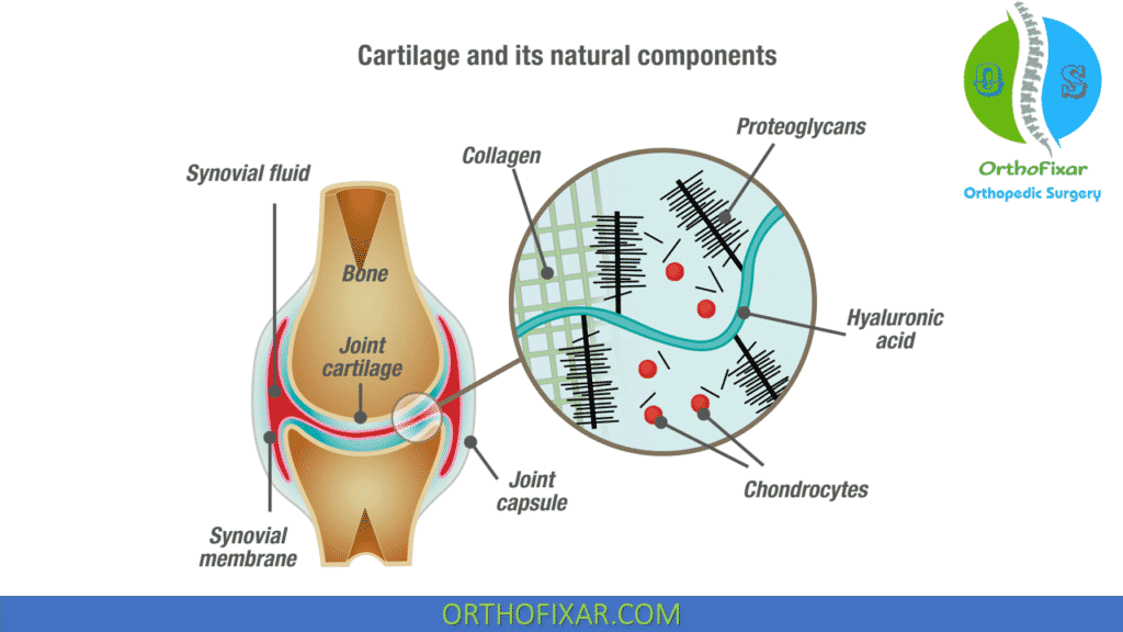 Hyaluronic Acid in knee cartilage