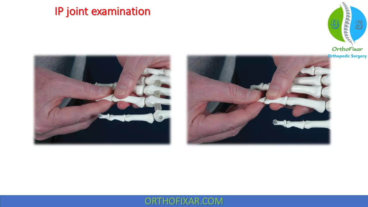 IPs joints assessment