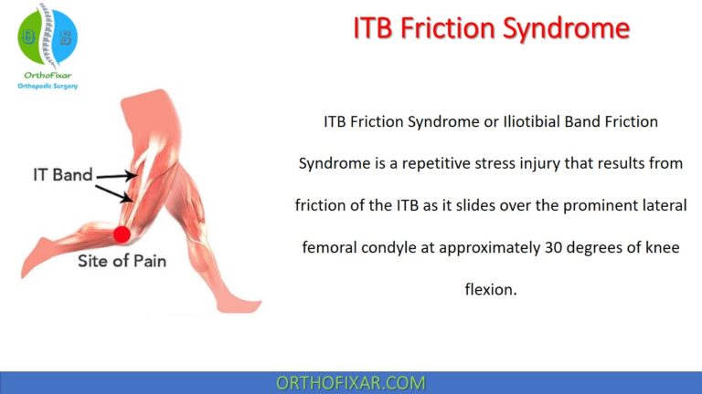 ITB Friction Syndrome