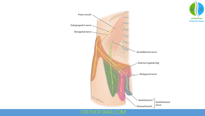 Ilioinguinal Neuralgia Overview 1 Ilioinguinal Nerve Anatomy
