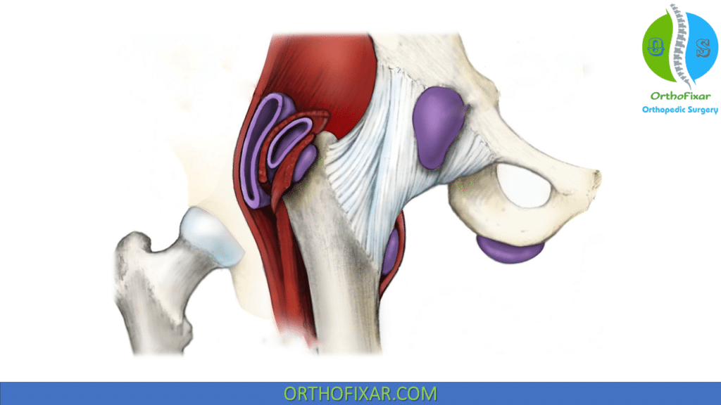 Iliopsoas Bursa anatomy