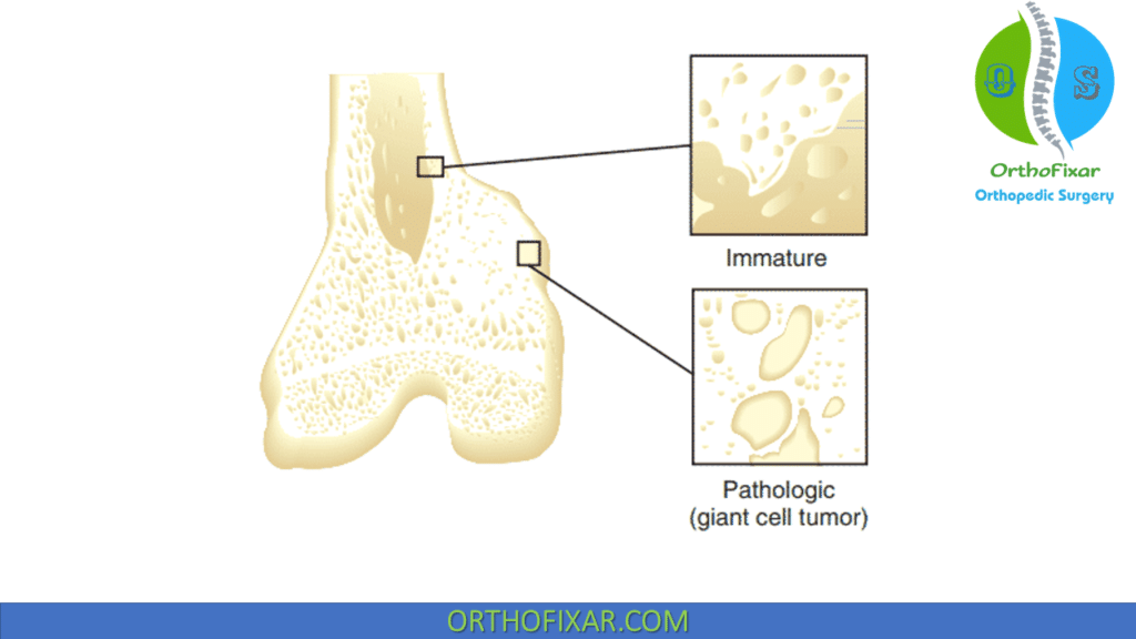 Immature & pathological bone