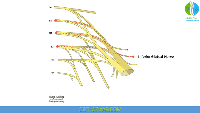 Inferior Gluteal Nerve Anatomy 1 Inferior Gluteal Nerve origin