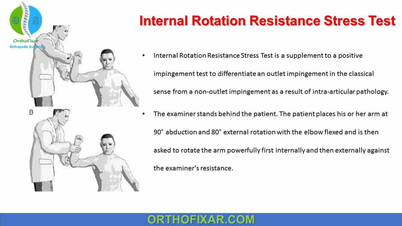  Internal Rotation Resistance Stress Test 