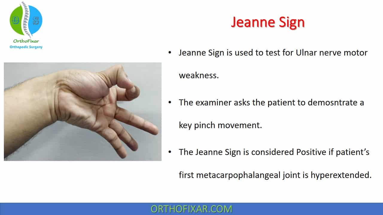  Jeanne Sign | Ulnar Nerve Evaluation 