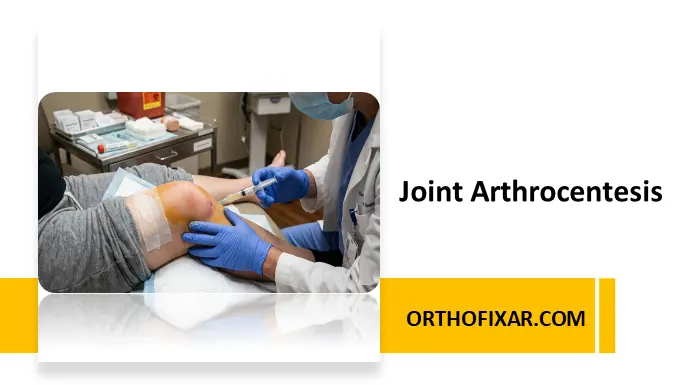 Joint Arthrocentesis
