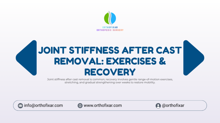 stiffness after cast removal