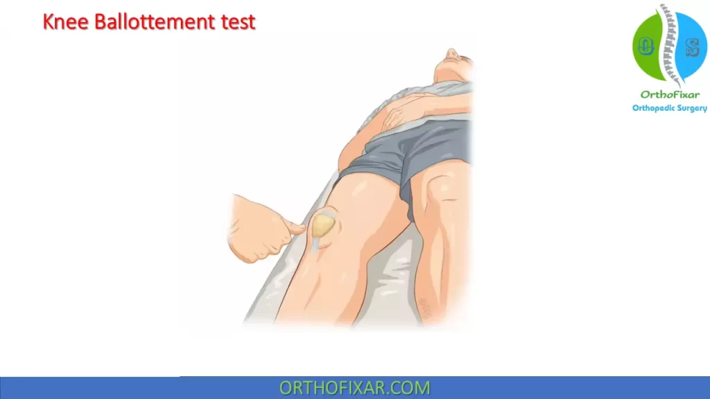 Knee Ballottement test
