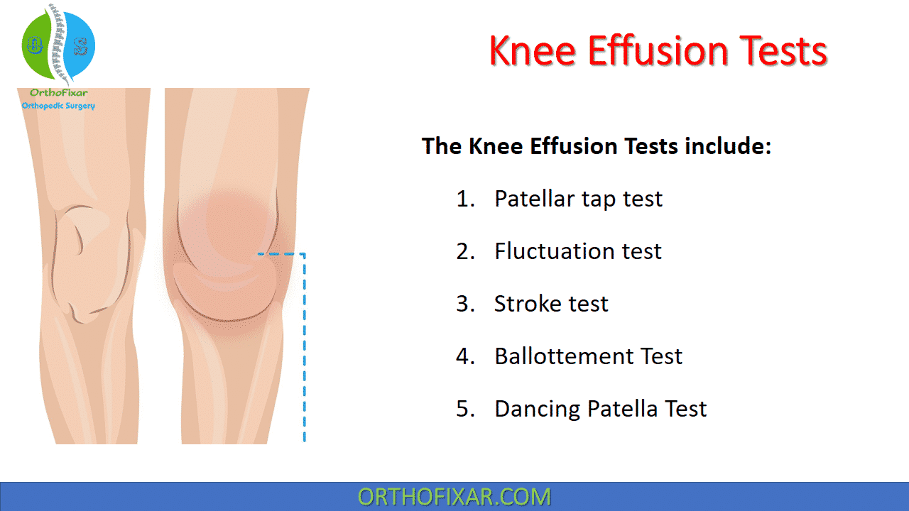  Knee Effusion Tests 