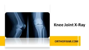 Knee Joint X Ray imaging