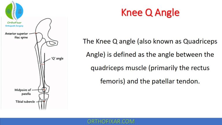 Knee Q Angle