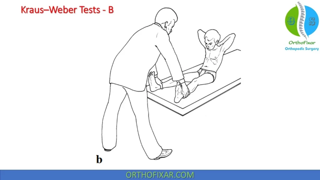 Kraus–Weber Tests - B