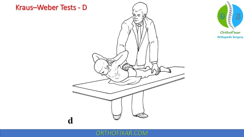 Kraus–Weber Tests - D