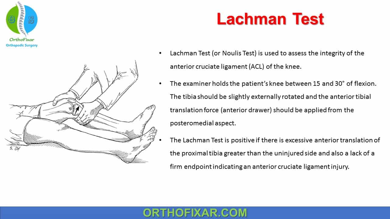 Lachman Test 2023 OrthoFixar (2023)