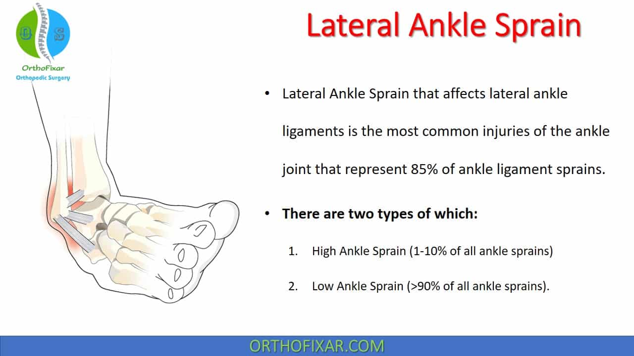 The Lower Ankle Sprain