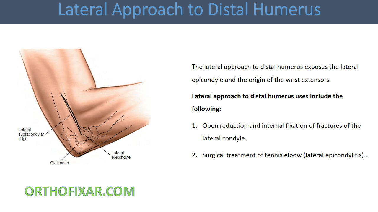  Lateral Approach to Distal Humerus 