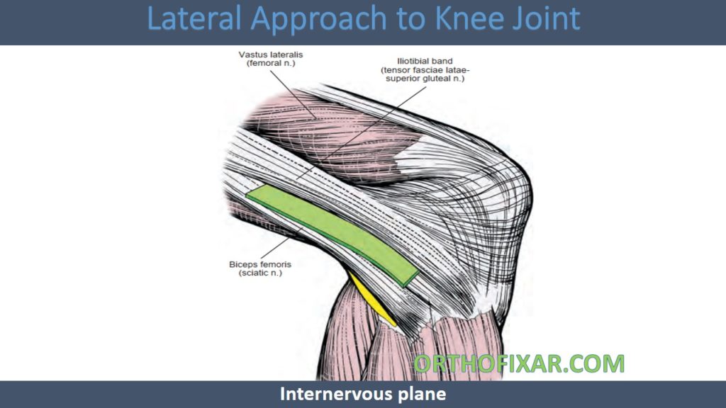 Lateral Approach to Knee Joint