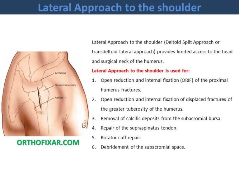 Lateral Approach to the shoulder